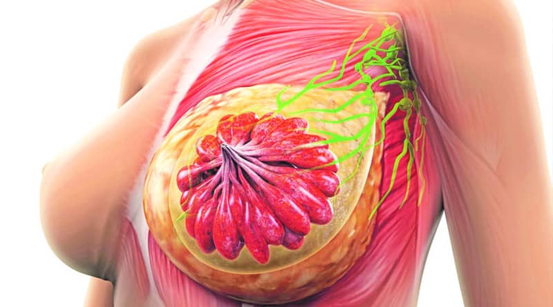 CBD for Breast Cancer